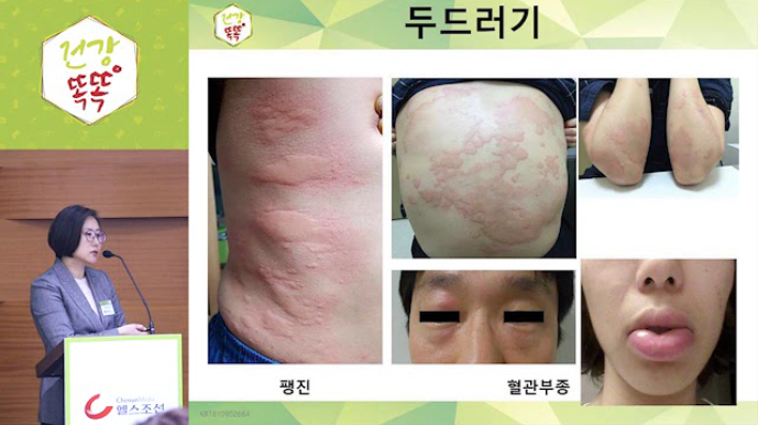 영상 썸네일