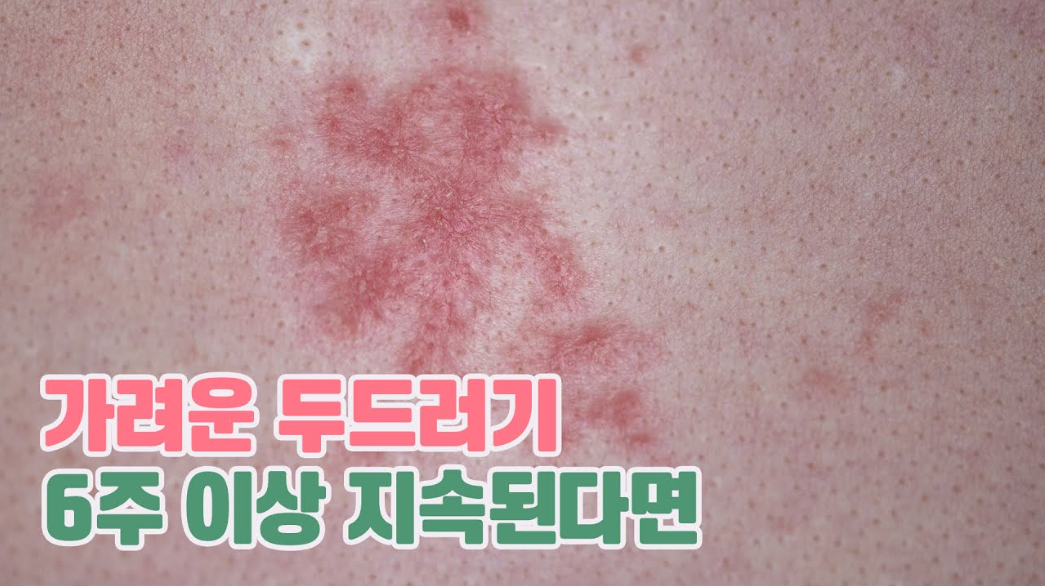 영상 썸네일